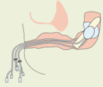 Fig-1.gif