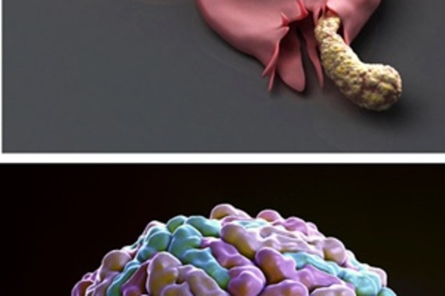 Blood Cells Infected By Malaria & Dengue Virus - Science Source