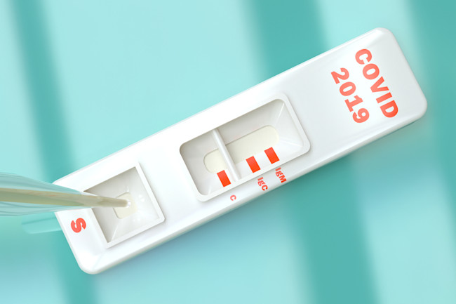 What Do Covid 19 Antibody Tests Show And Can The Results Be