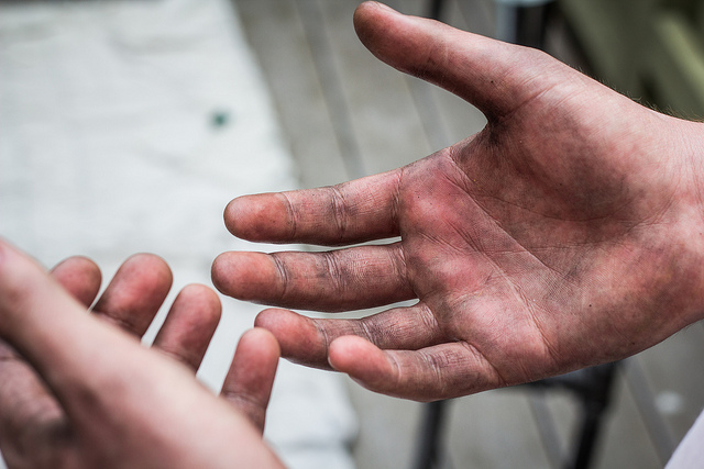 Study finds that the popular rubber hand illusion could be used to treat  OCD