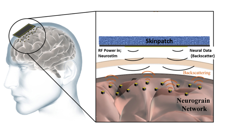 neurograins.jpg