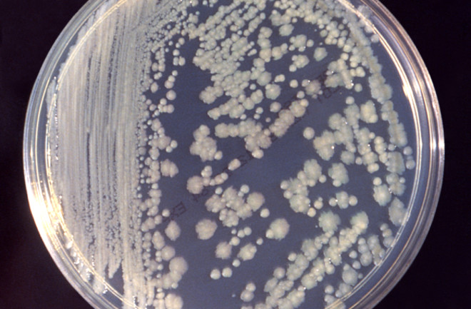 Enterobacter cloacae bacteria cultured in a petri dish. In a new study, scientists have investigated the antibiotic-resistance of bacteria on the space station. (Credit: CDC)