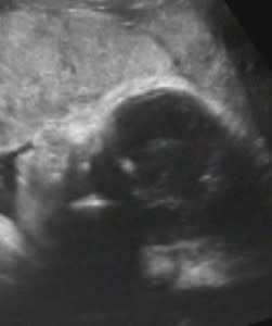 profilePlacenta-251x300.jpg
