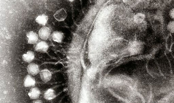 Phage-Phi6.jpg