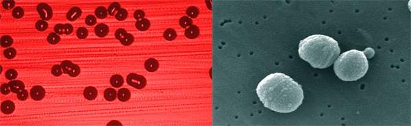 Haemophilius_Streptococcus.jpg