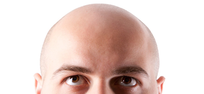 hair-3