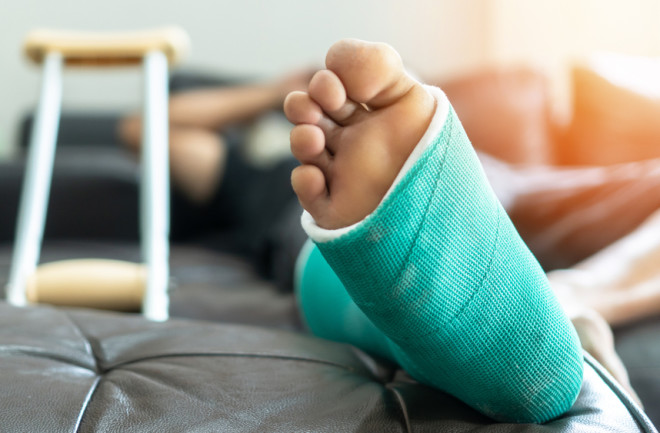 broken leg cast crutches - shutterstock