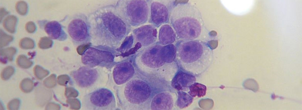 CTVT_cells.jpg