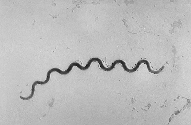 A photomicrograph of a Treponema pallidum bacterium, a spirochete that ranges from 5 to 15 micrometers in length, and is the causative agent of syphilis. Image: CDC/Susan Lindsley.