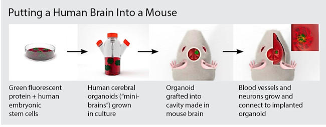 human-brain-mouse