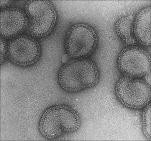 flu.jpg