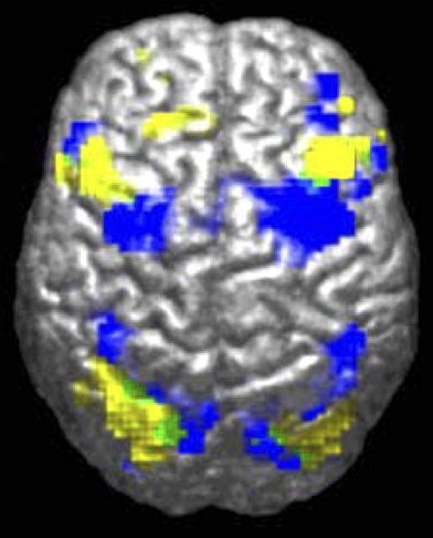 fmri.jpeg
