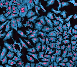 hela-cells-microscope