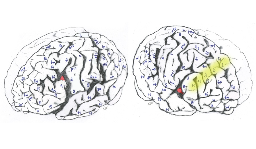 brain-chart