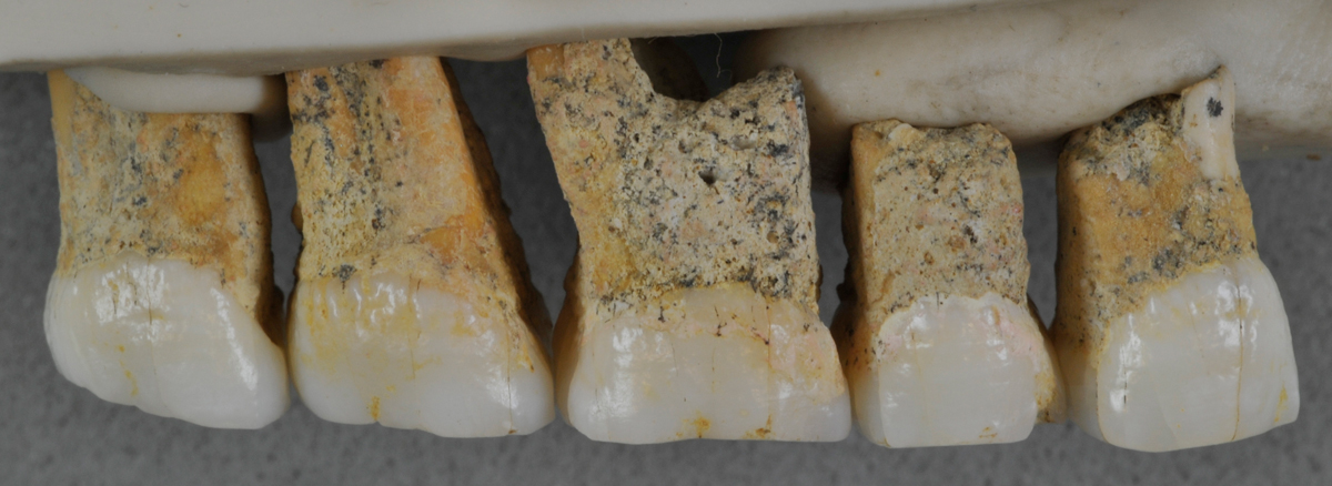 Luzon-Teeth.jpg