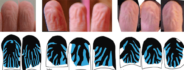 Why Do Fingers Prune?, TS Digest