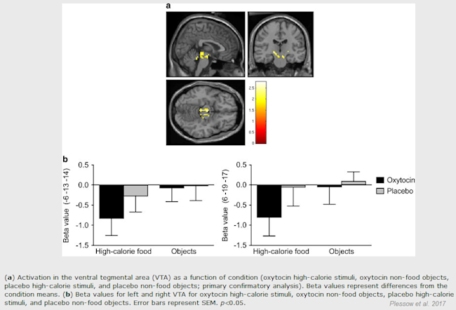 plessow_fmri.png