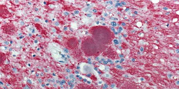 Prions.jpg