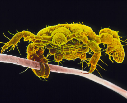 What The Bugs That Live On Our Bodies Say About Human History