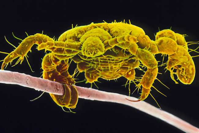 What The Bugs That Live On Our Bodies Say About Human History