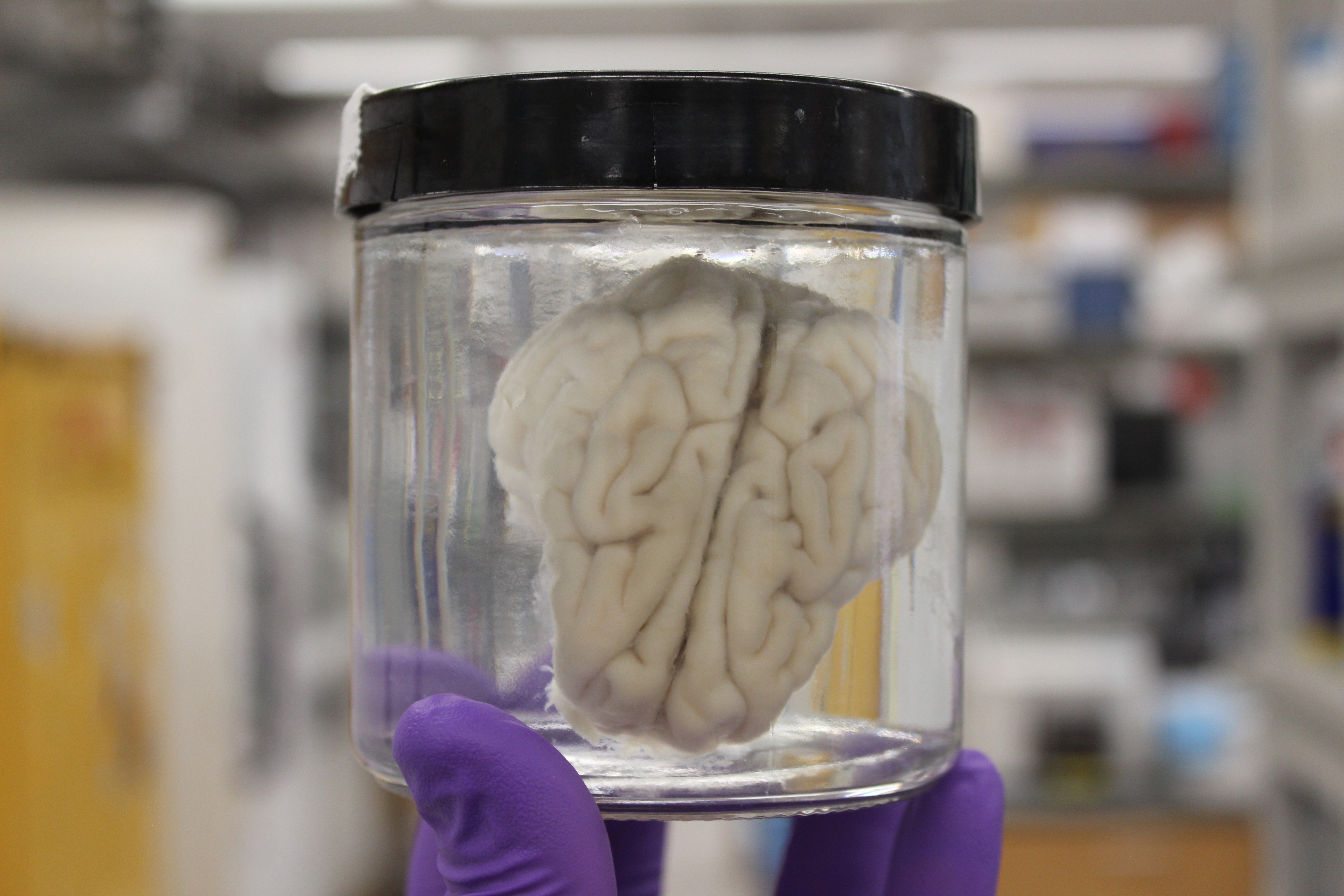 real human brain in a jar
