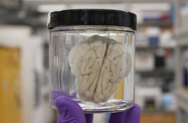 Brain in Jar - Yale