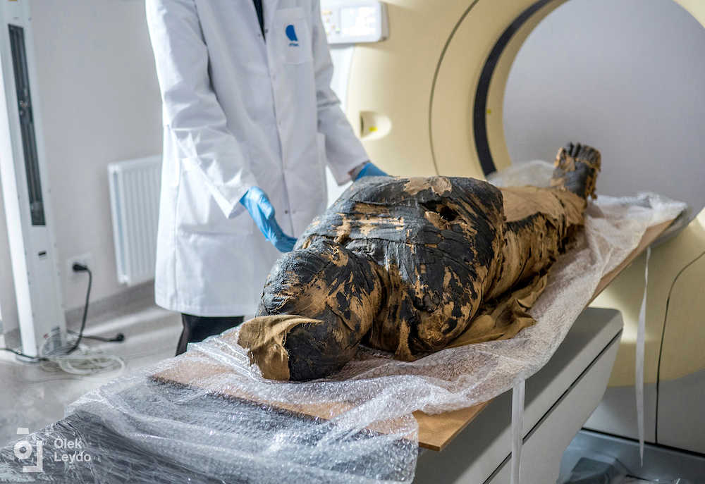A Closer Look at the World's First Pregnant Egyptian Mummy