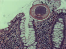 worm-xsection-101201-02.jpg