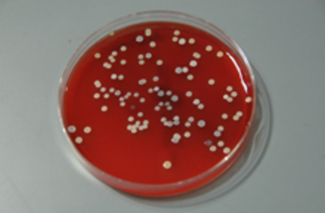 skin-bacteria.jpg