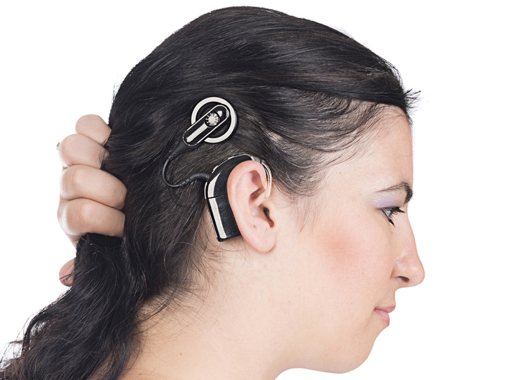 cochlear-implant.jpg