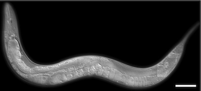 nematode.jpg