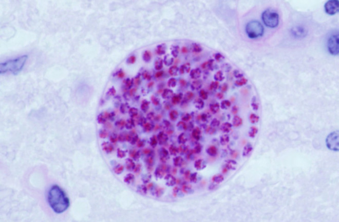 Toxoplasma gondii cysts - USDA 