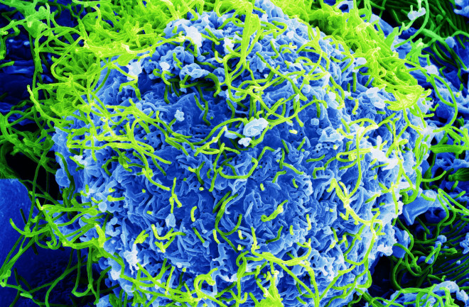 Ebola Vero Cell - National Institute of Allergy and Infectious Diseases