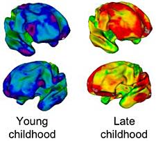 brains225.jpg