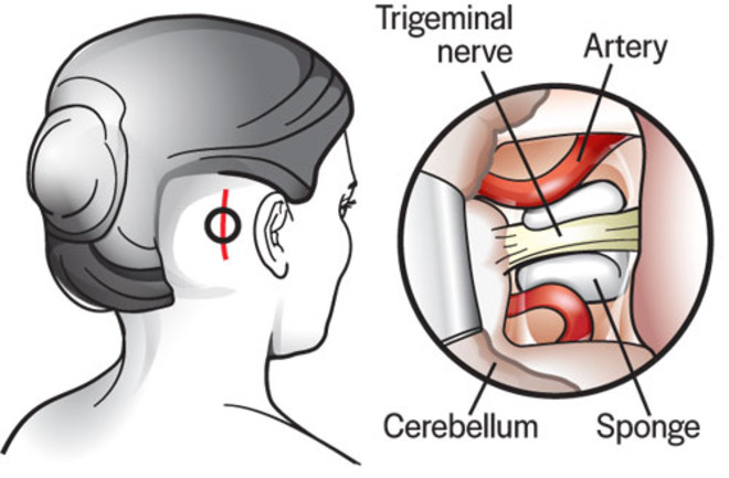 surgical-treatment.jpg