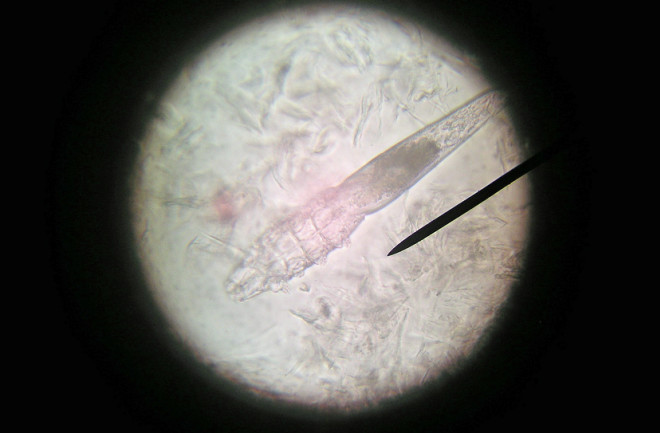 demodex.jpg