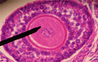 Follicle.jpg
