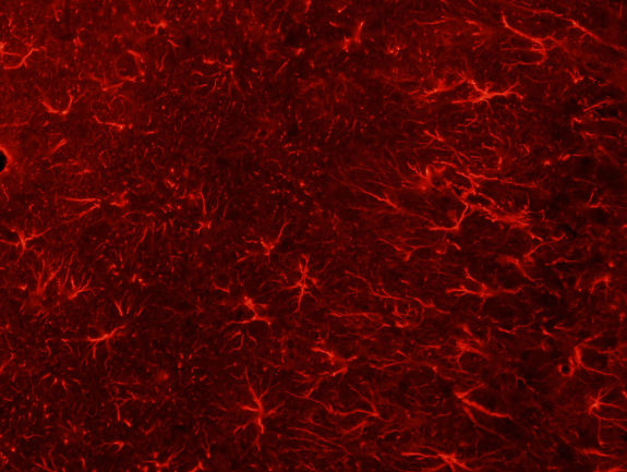 glia-cells.jpg