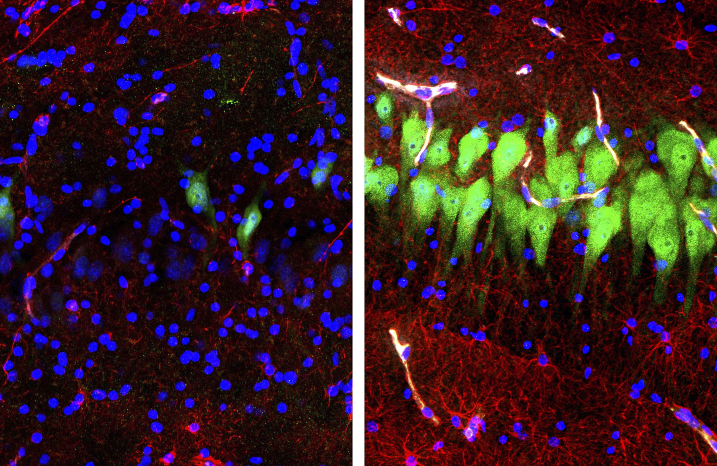 Resurrected Neurons - Yale