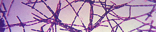 Anthrax.jpg