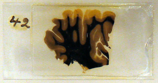 Slice of Einstein's Brain on a Slide - Reuters