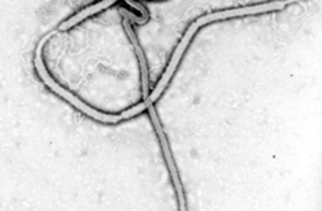 Ebolavirus.jpg