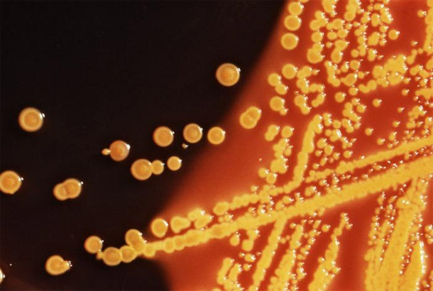 E.coli_.jpg