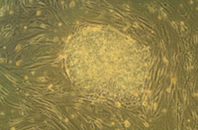 stem-cells.jpg