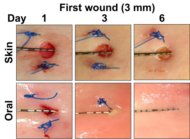 How to heal a lip cut