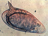 Schistosoma_mansoni.jpg