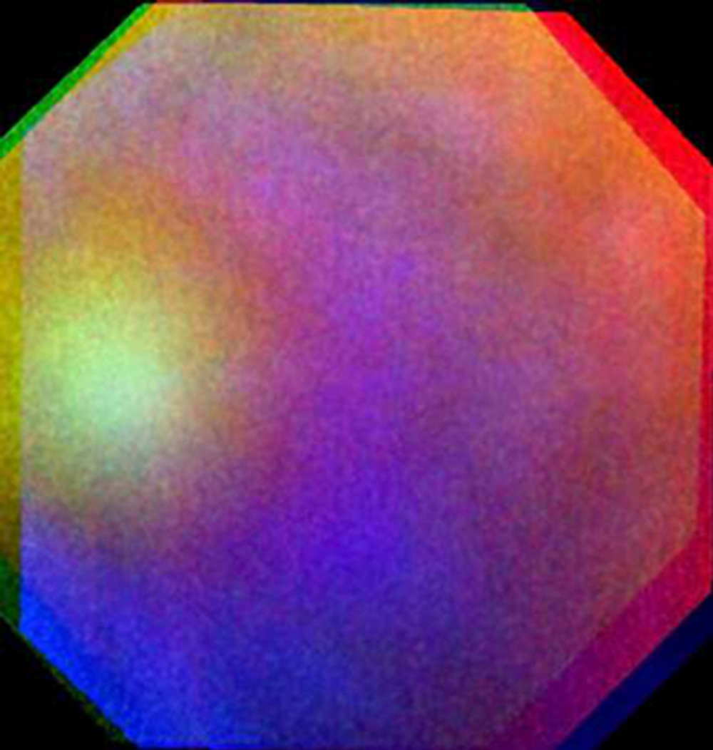 venus_glory.jpg