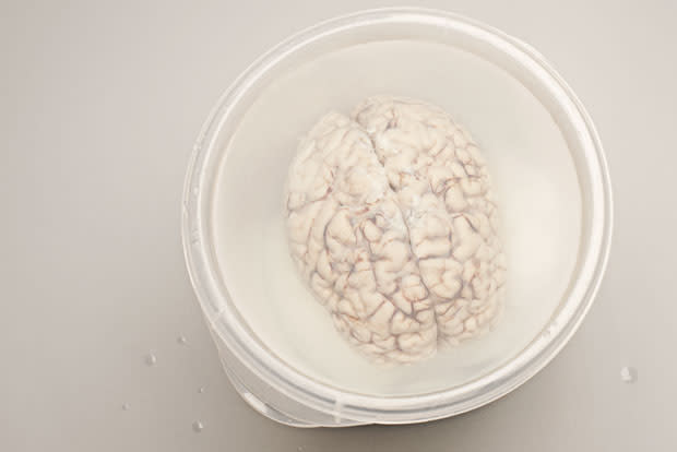 brainhm1.jpg