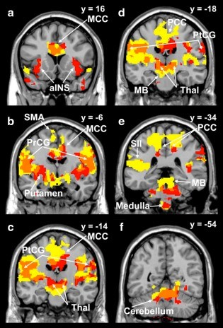 coughing-brain.jpg