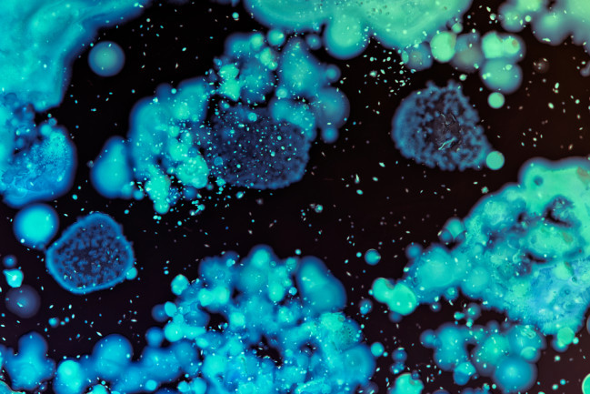 Beautiful blue and green bacteria inside a petri dish.